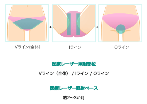 VIOハイジニーナの対象部位