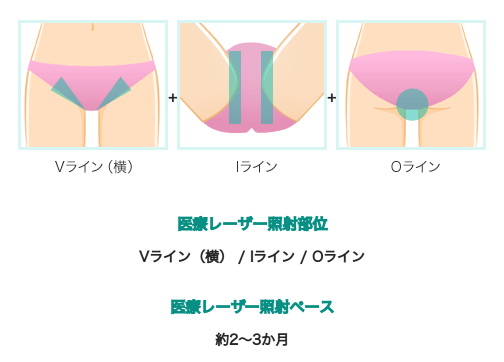 VIOエチケットの対象部位