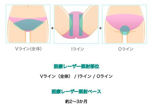 VIOハイジニーナの対象部位